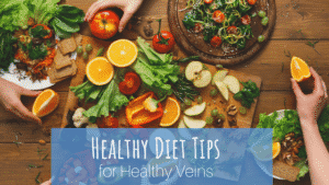 Healthy Diet Tips for Healthy Veins - Summit Skin Care