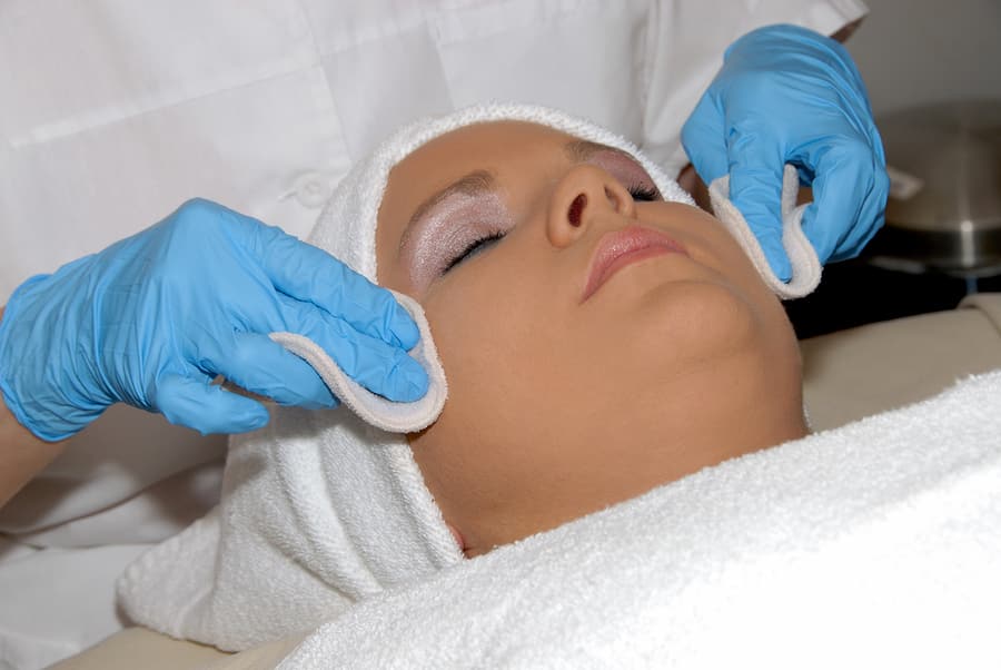 Chemical peel/microdermabrasion treatment in progress